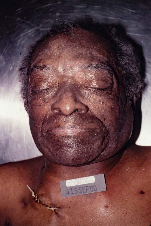 Unidentified Male Found in Chicago in 1992, Dies in 2000; Investigation Still Ongoing